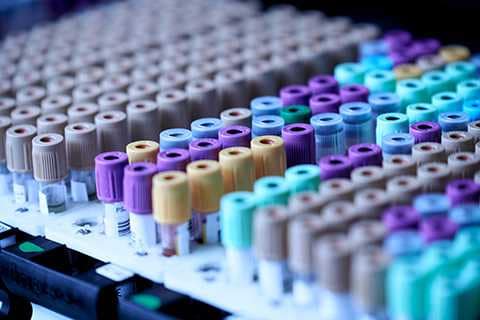 Д-димер као добра превентива